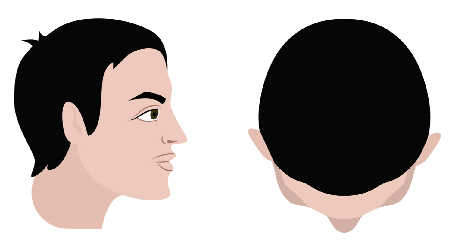 Stage 1