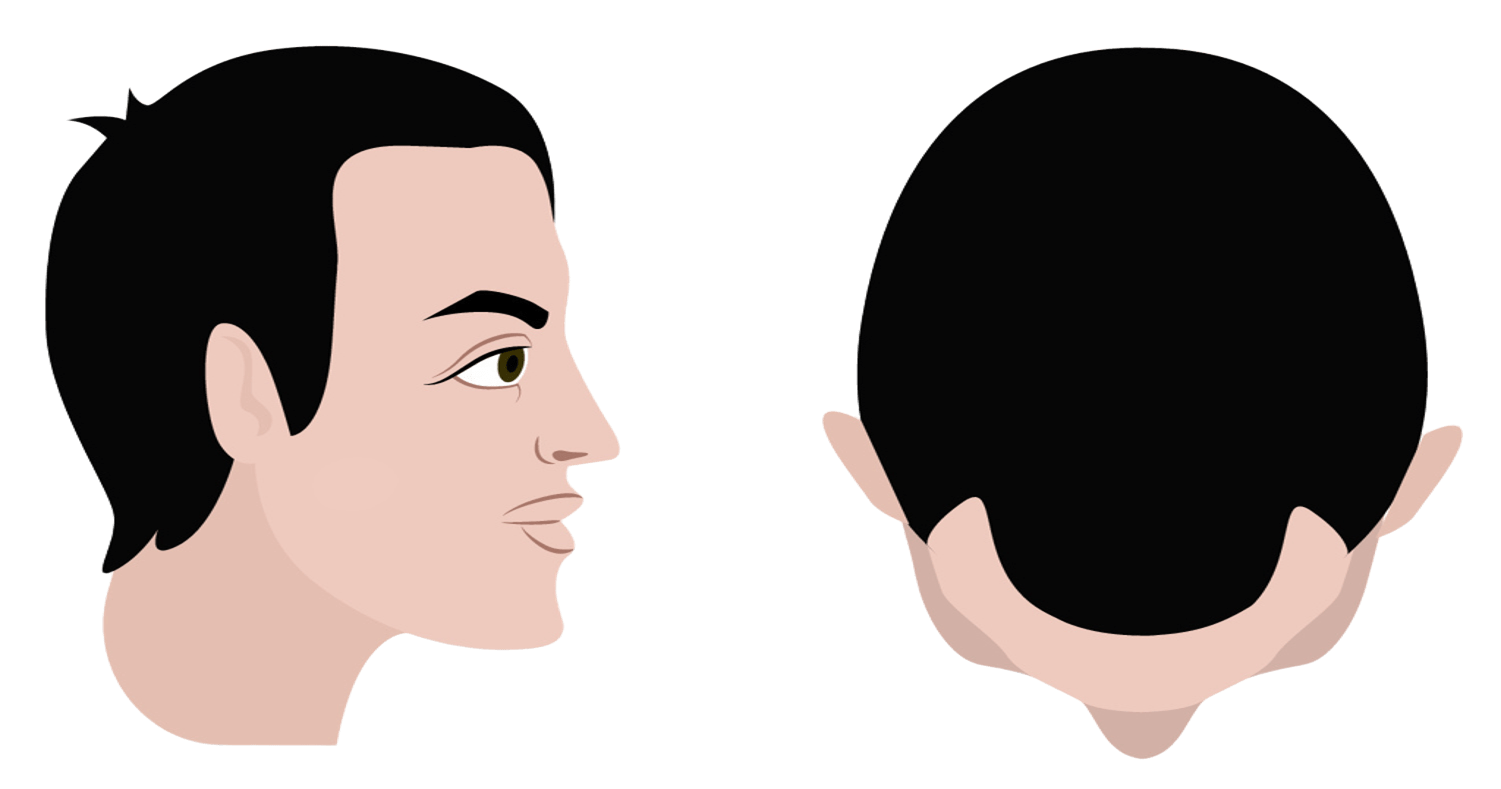 Stage 2