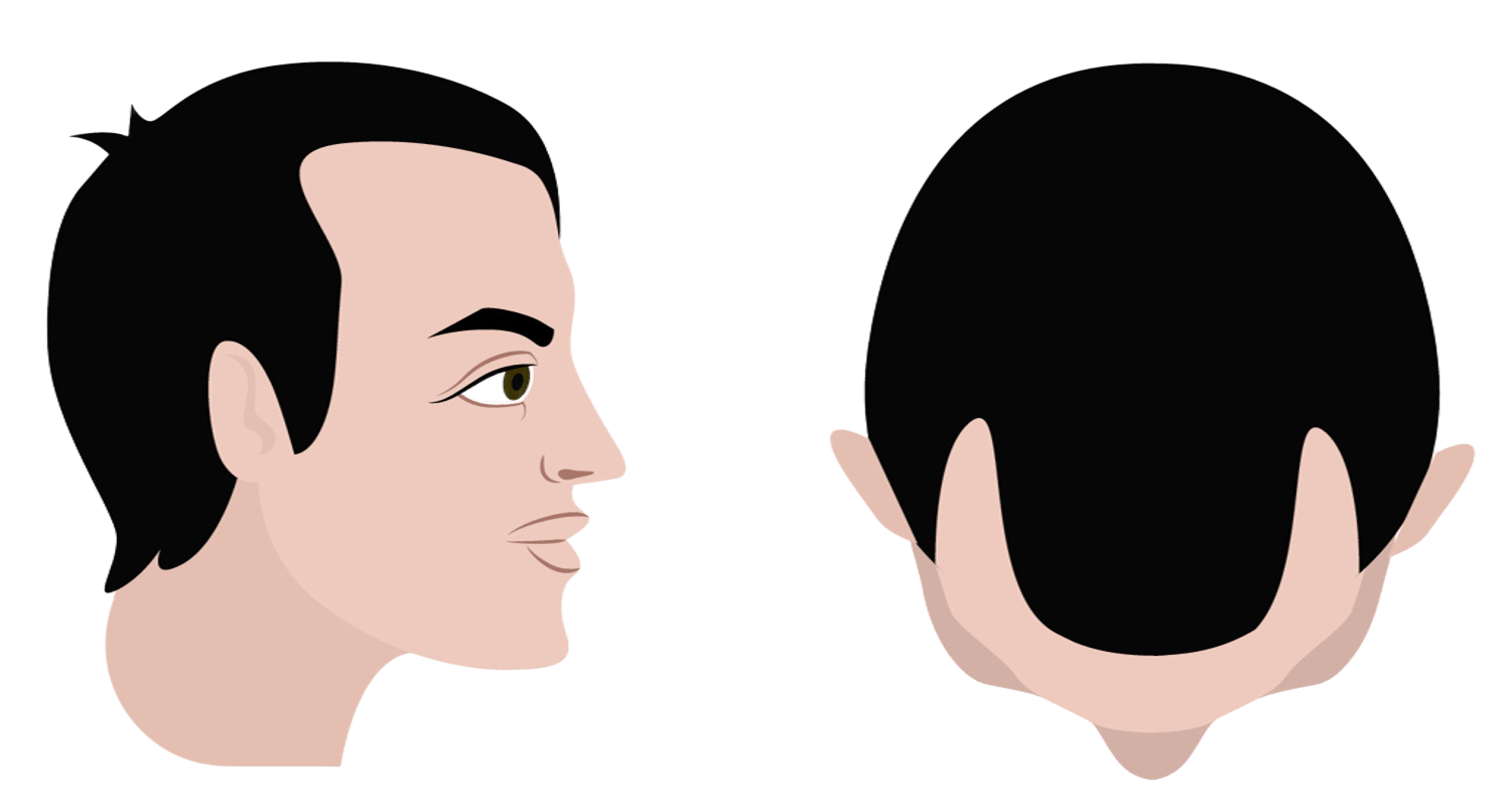 Stage 3