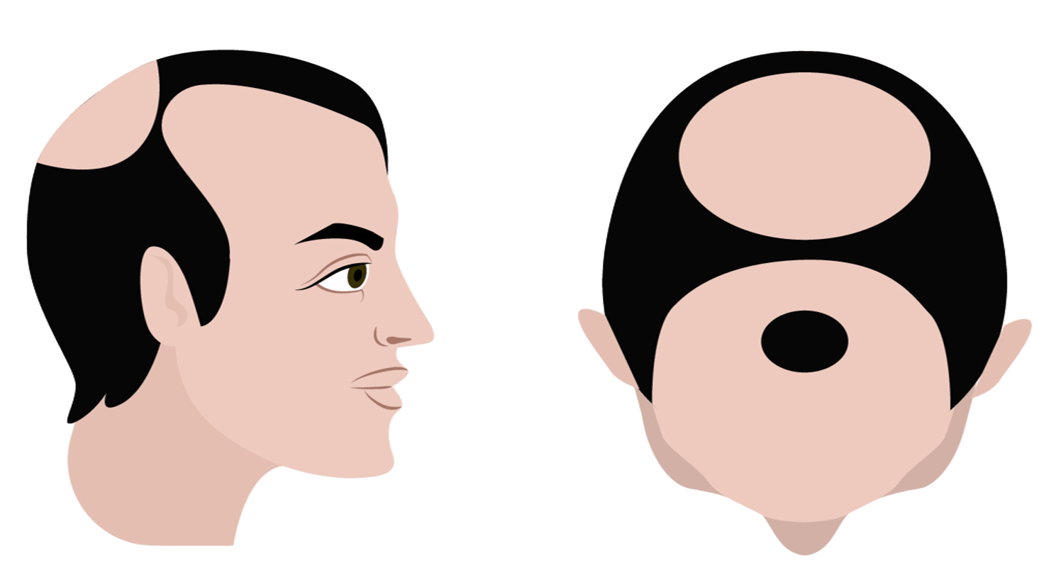 Stage 6
