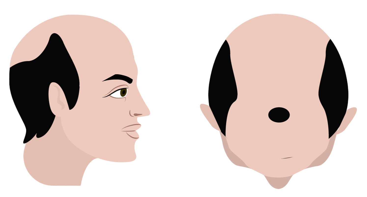 Stage 7