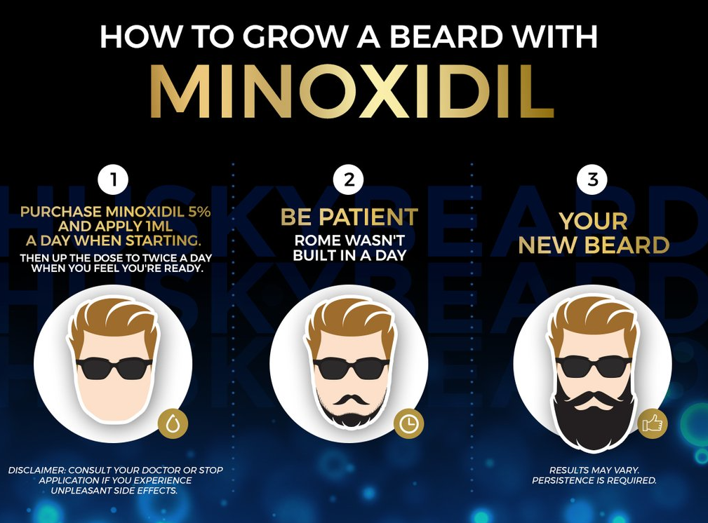 Hair loss treatment with Minoxidil