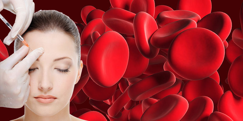 Plasma injections